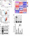 Quantitative proteomics reveals the upregulation of PARP1-EJ proteins in ER