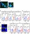 DSB analysis in ERG-positive and ERG-negative cells within PCa TSCs.