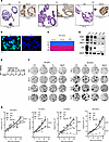 Combined treatment with olaparib and IR delays the tumor growth selectively