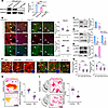 Decline of DNAJC6 levels in astrocytes within the context of PD.
