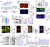 DNAJC6 KD in astrocytes promotes a proinflammatory phenotype through disrup