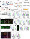 DNAJC6 overexpression by CRISPR-SAM (a CRISPRa system) rescues motor defici