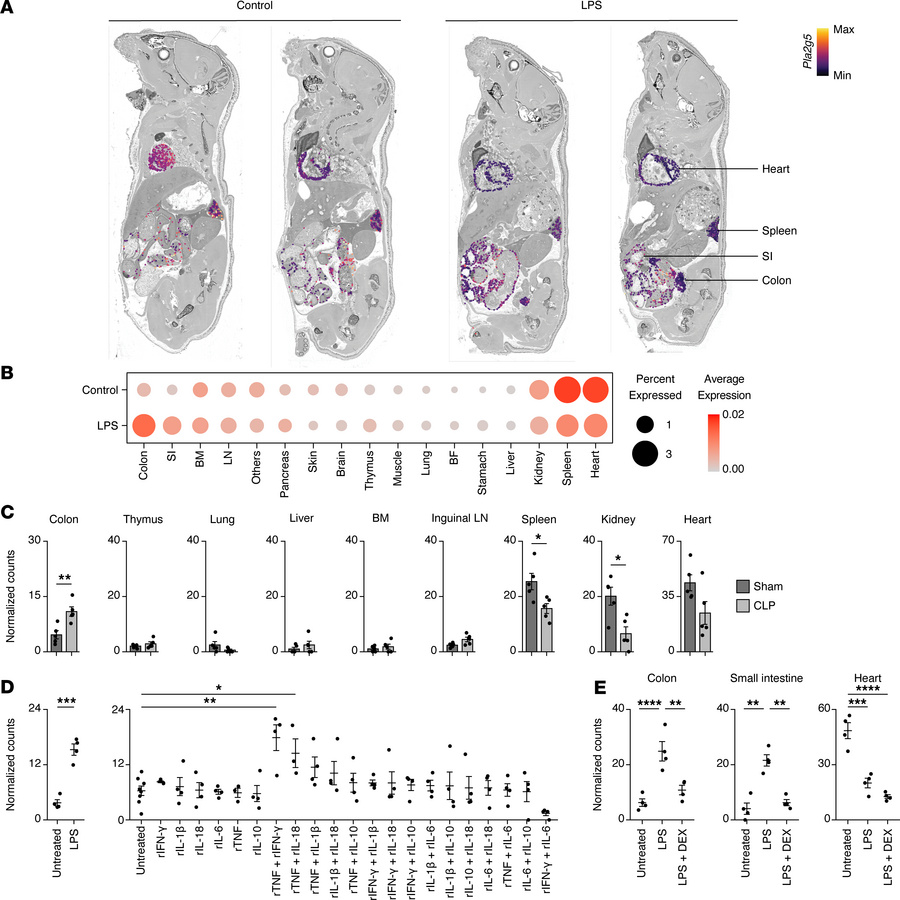 PLA2G5 is induced in the colon during sepsis.
(A) Whole-mouse spatial tr...