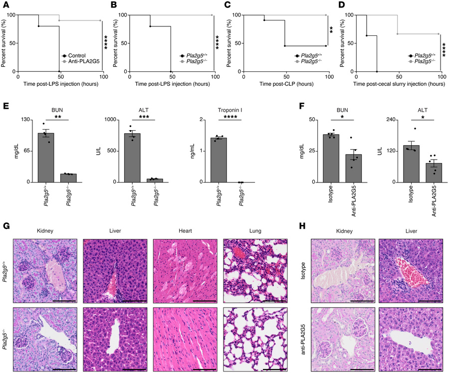 PLA2G5 leads to multiorgan failure during sepsis.
(A–D) Survival curves ...
