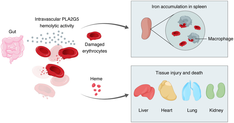 Schematic depicting the proposed model for the role of PLA2G5 in sepsis....