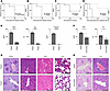PLA2G5 leads to multiorgan failure during sepsis.