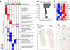 PLA2G5 antibody treatment increases splenic red pulp macrophages and iron h