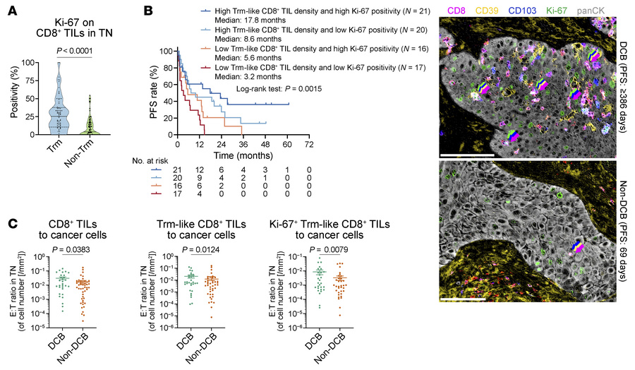 Association of Ki-67 expression in Trm-like CD8+ T cells with ICI effica...