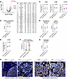 EGFR-mutation–associated gene expression and spatial immune features.