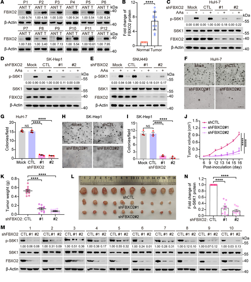 FBXO2 promotes the progression of HCC by activating mTORC1.
(A) Liver tu...