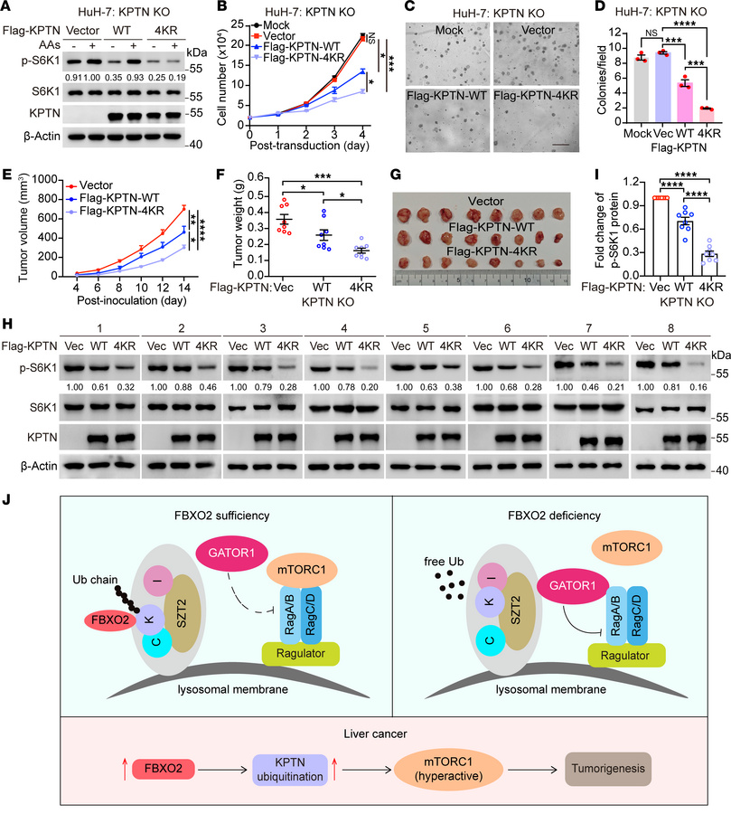 FBXO2-mediated KPTN ubiquitination drives HCC progression via mTORC1 act...