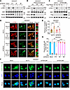 FBXO2 promotes amino acid–induced mTORC1 activation.