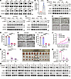 FBXO2 promotes the progression of HCC by activating mTORC1.
