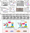 FBXO2-mediated KPTN ubiquitination drives HCC progression via mTORC1 activa