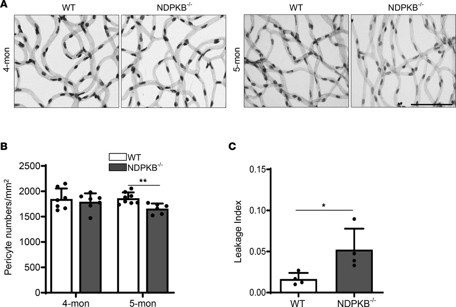 Vascular hyperpermeability and pericyte loss were observed in 5-month-ol...