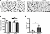 Vascular hyperpermeability and pericyte loss were observed in 5-month-old N