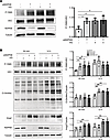 VE-cadherin Y685 phosphorylation is triggered by HG and NDPKB deficiency, p