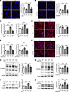 VE-cadherin Y685 phosphorylation impairs protein O-GlcNAcylation, Ang2 upre