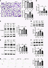Suppressing VE-cadherin Y685 phosphorylation reverses HBP activation and re