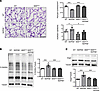 Suppressing VE-cadherin Y685 phosphorylation reverses HBP activation and re