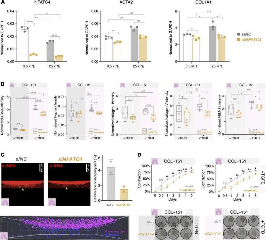 
NFATC4 knockdown attenuates fibroblast-to-myofibroblast transition, col...