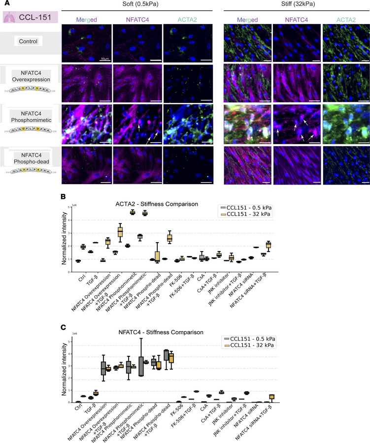 
NFATC4 phosphorylation regulates myofibroblast differentiation on soft ...
