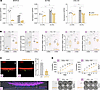 NFATC4 knockdown attenuates fibroblast-to-myofibroblast transition, collage