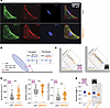 NFATC4 knockdown alters nuclear morphology and positioning on fibronectin m