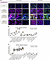NFATC4 phosphorylation regulates myofibroblast differentiation on soft and