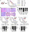 Msh2 germline loss drives low-grade to high-grade glioma progression.