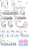 ANKRD55 promotes disease progression of MOG35–55-induced EAE.