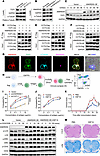 ANKRD55 affects CCT complex assembly by competing with CCT5 binding to CCT1