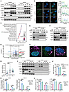USP5 deficiency promotes LC3-dependent secretory autophagy of p-STAT1/2.