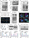 USP5 depletion enhances STAT2 ubiquitination to permit its binding with LC3