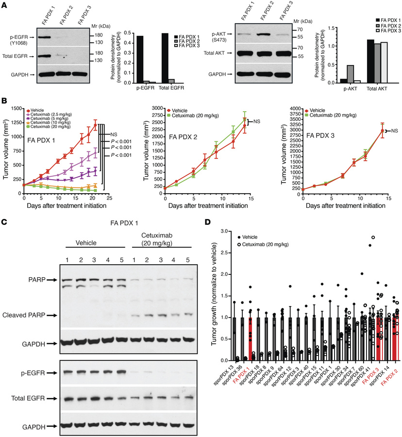 FA PDX 1 expresses high levels of EGFR and is highly sensitive to cetuxi...