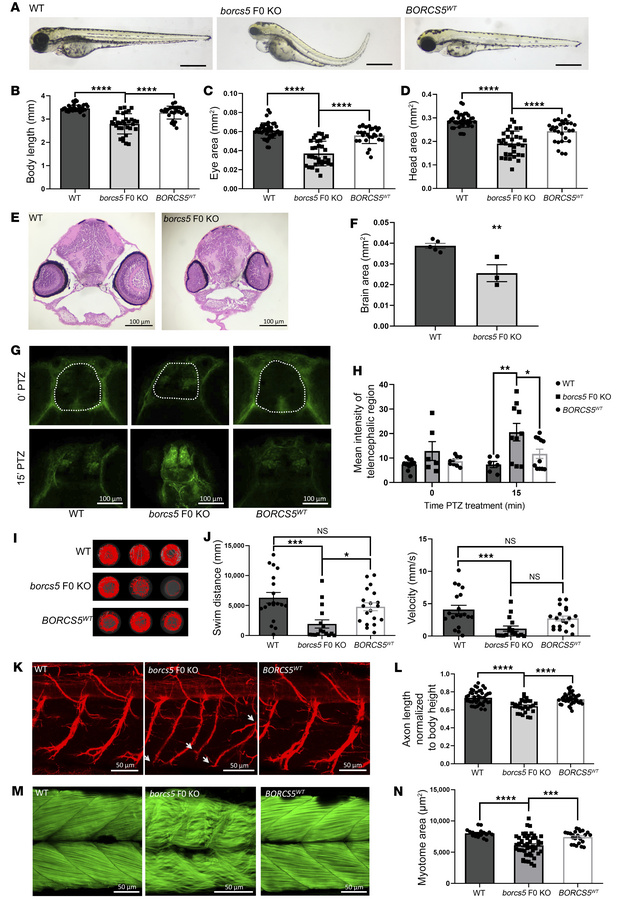 Zebrafish borcs5-ko larvae exhibit developmental defects and recapitulat...