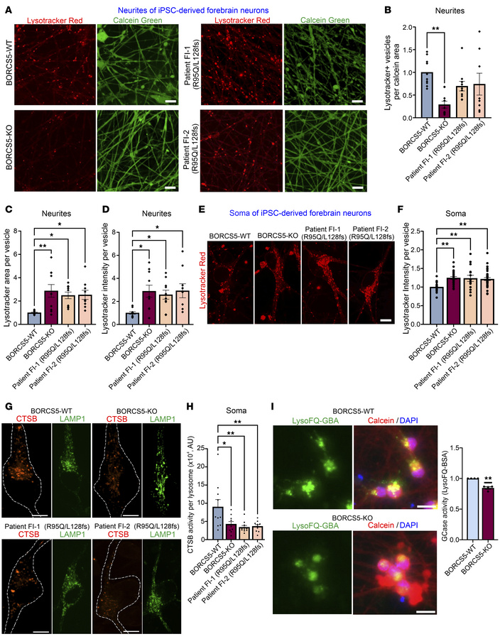 Lysosome-dispersal activity of patient-specific BORCS5 variants.
Increas...