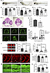 Zebrafish borcs5-ko larvae exhibit developmental defects and recapitulate p