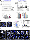 Impact of BORCS5 pathogenic variants on BORCS5 protein expression, BORC ass