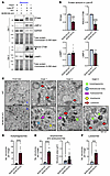BORCS5 deficiency leads to lysosomal dysfunction in iNeurons.