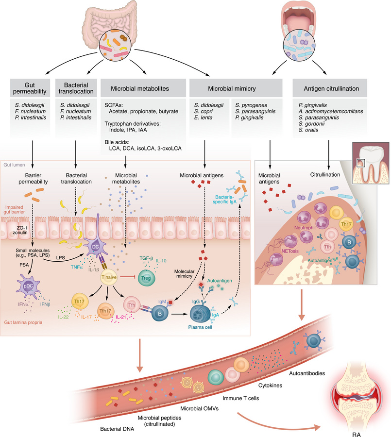 Potential mechanistic effects of the microbiome in RA pathogenesis.
Bact...