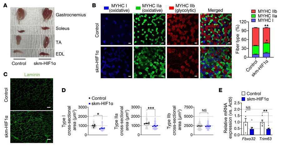 HIF1α in skeletal muscle increases the oxidative fiber ratio.
(A) Skelet...