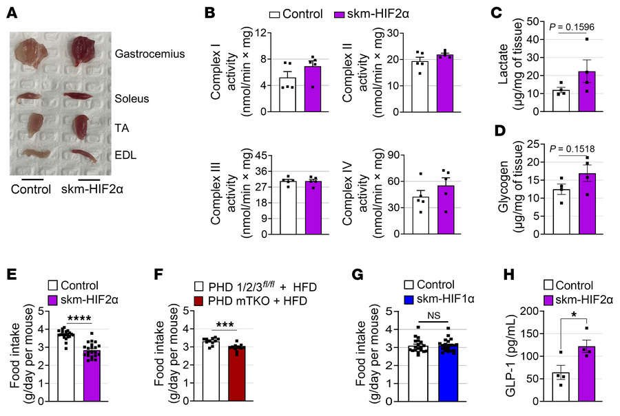 HIF2α stabilization exerts limited effects on mitochondrial function and...