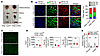 PHD deficiency in skeletal muscle increases oxidative fiber ratio.