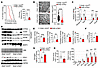 PHD deficiency in skeletal muscle impairs exercise endurance and mitochondr