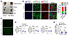 HIF1α in skeletal muscle increases the oxidative fiber ratio.