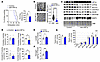 HIF1α in skeletal muscle impairs exercise performance.