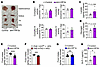 HIF2α stabilization exerts limited effects on mitochondrial function and re