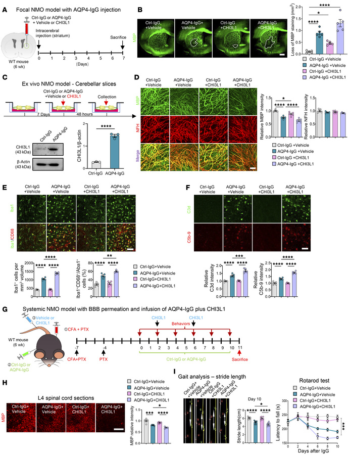 CHI3L1 amplifies demyelination and inflammation in NMO models driven by ...