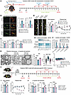 Astrocyte-secreted CHI3L1 is required for NMO-related demyelination, glial